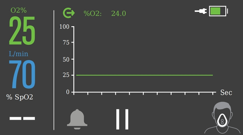 InterFlow-waveform-display-adult
