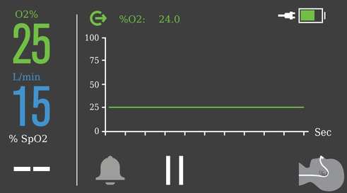 InterFlow-waveform-display-infant